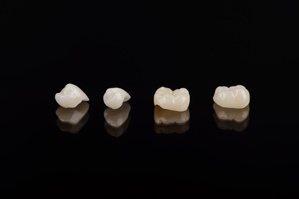 Types Of Dental Crowns