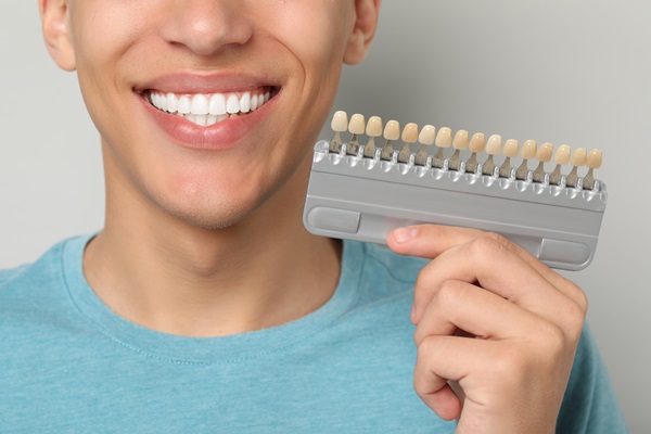 Understanding The Dental Veneers Process